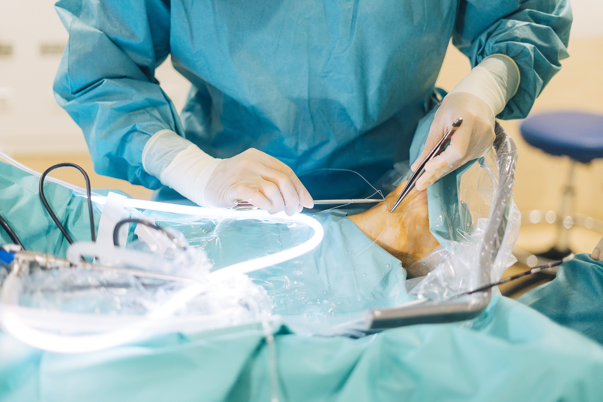 Achilles tendon ache surgery