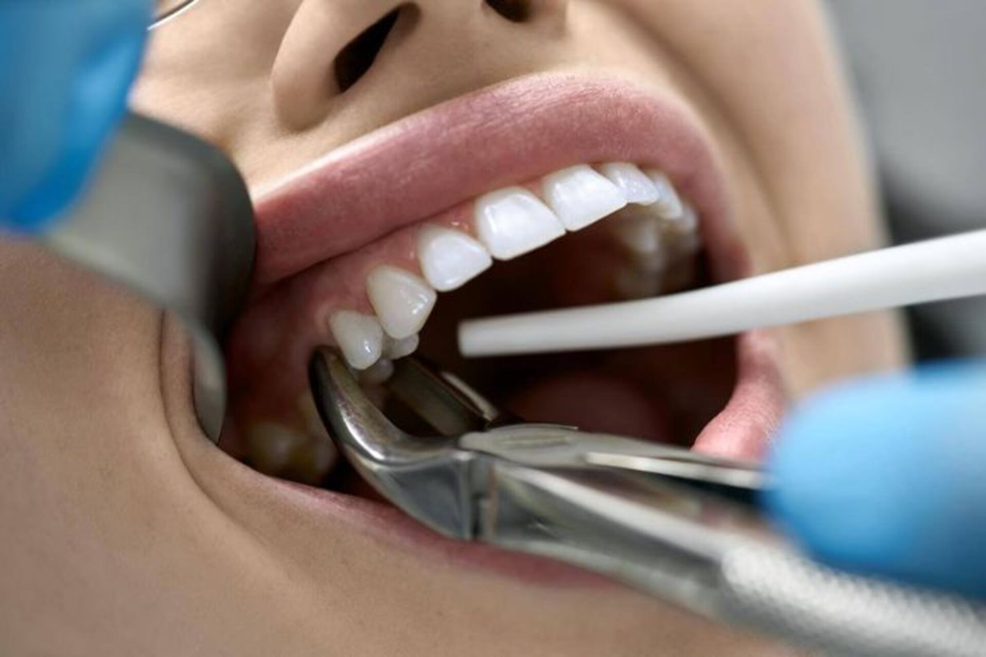 Regular dental check-ups help monitor wisdom tooth development. 