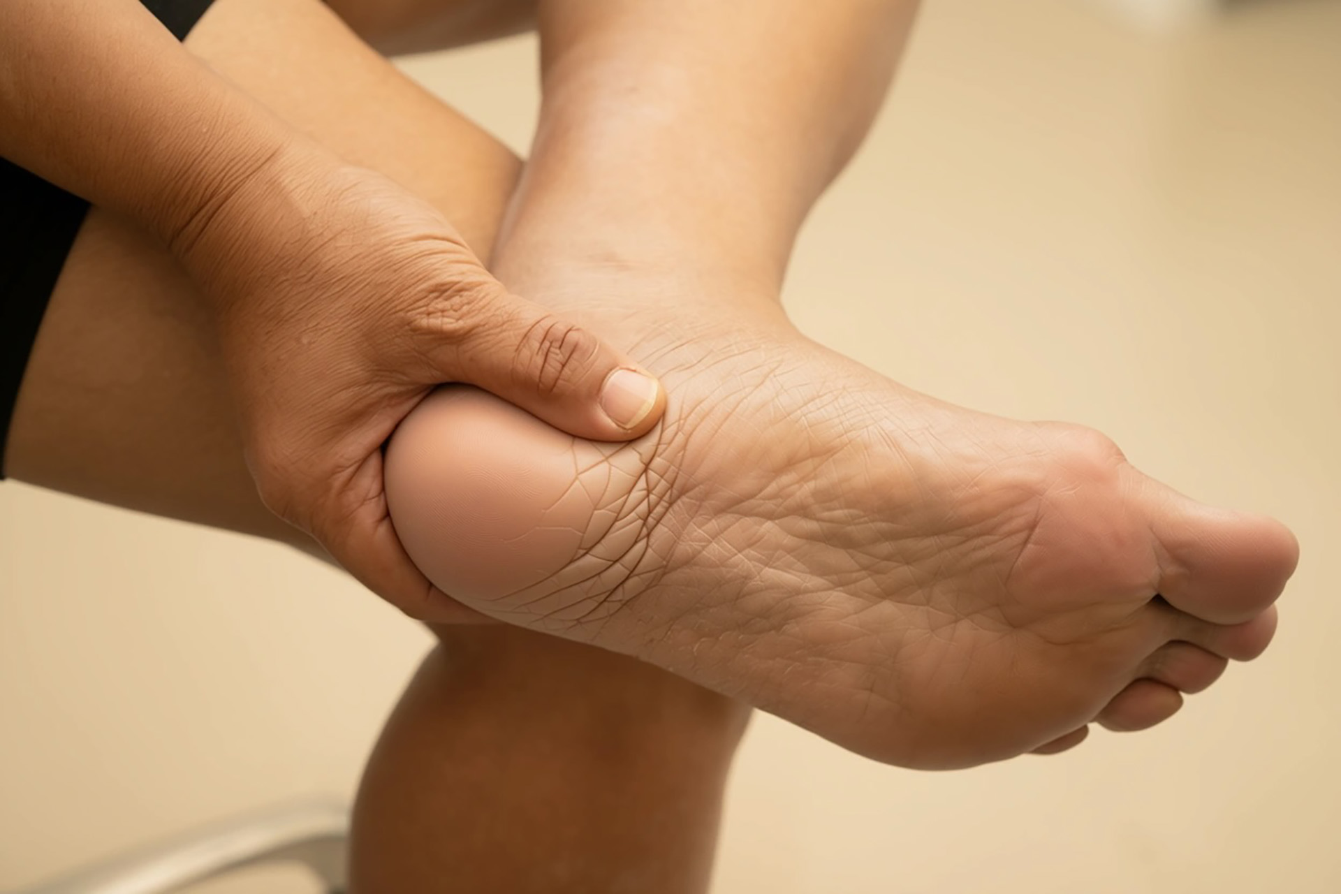 bunion pain after running