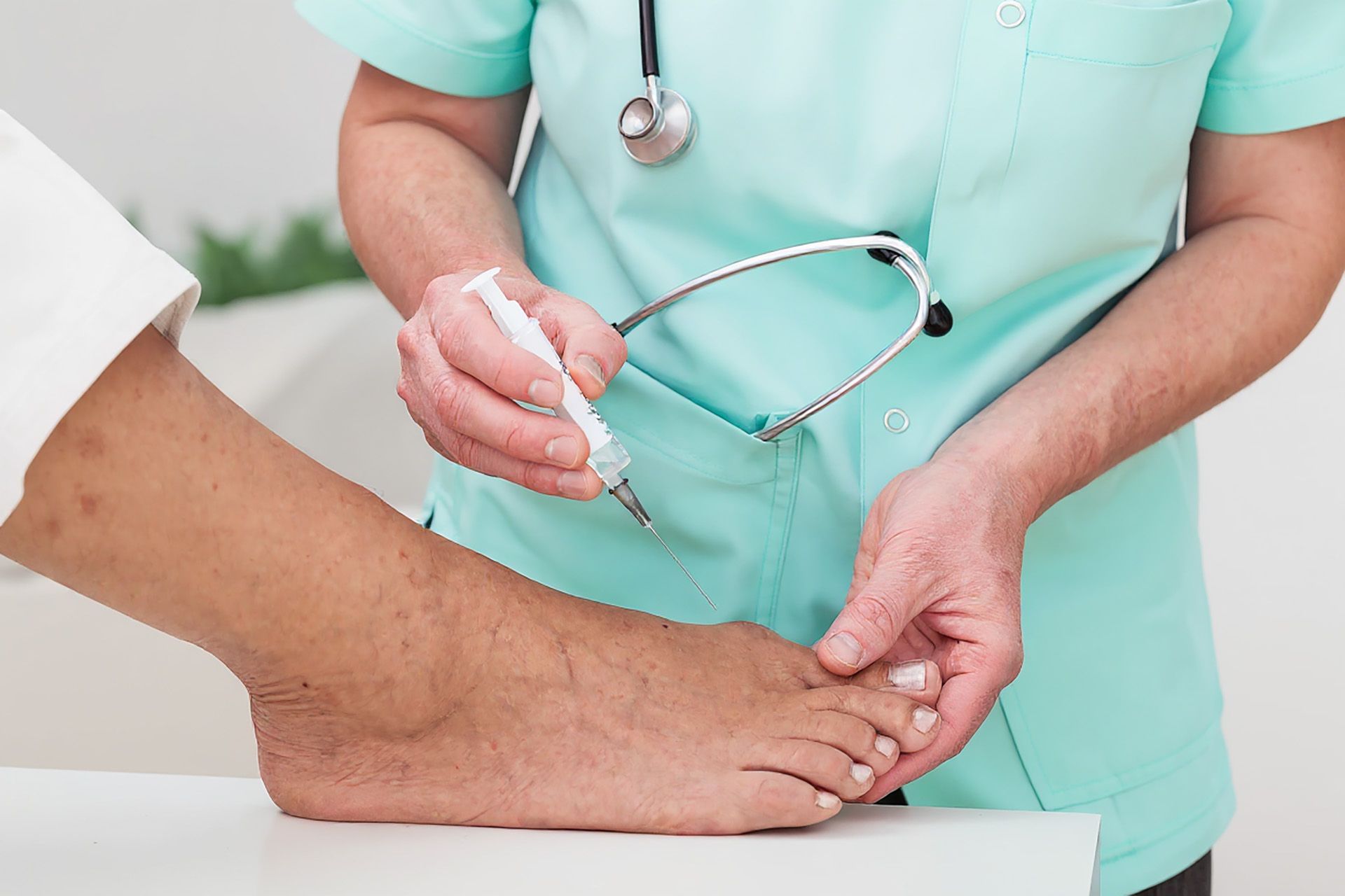 bunions orthotics in Singapore