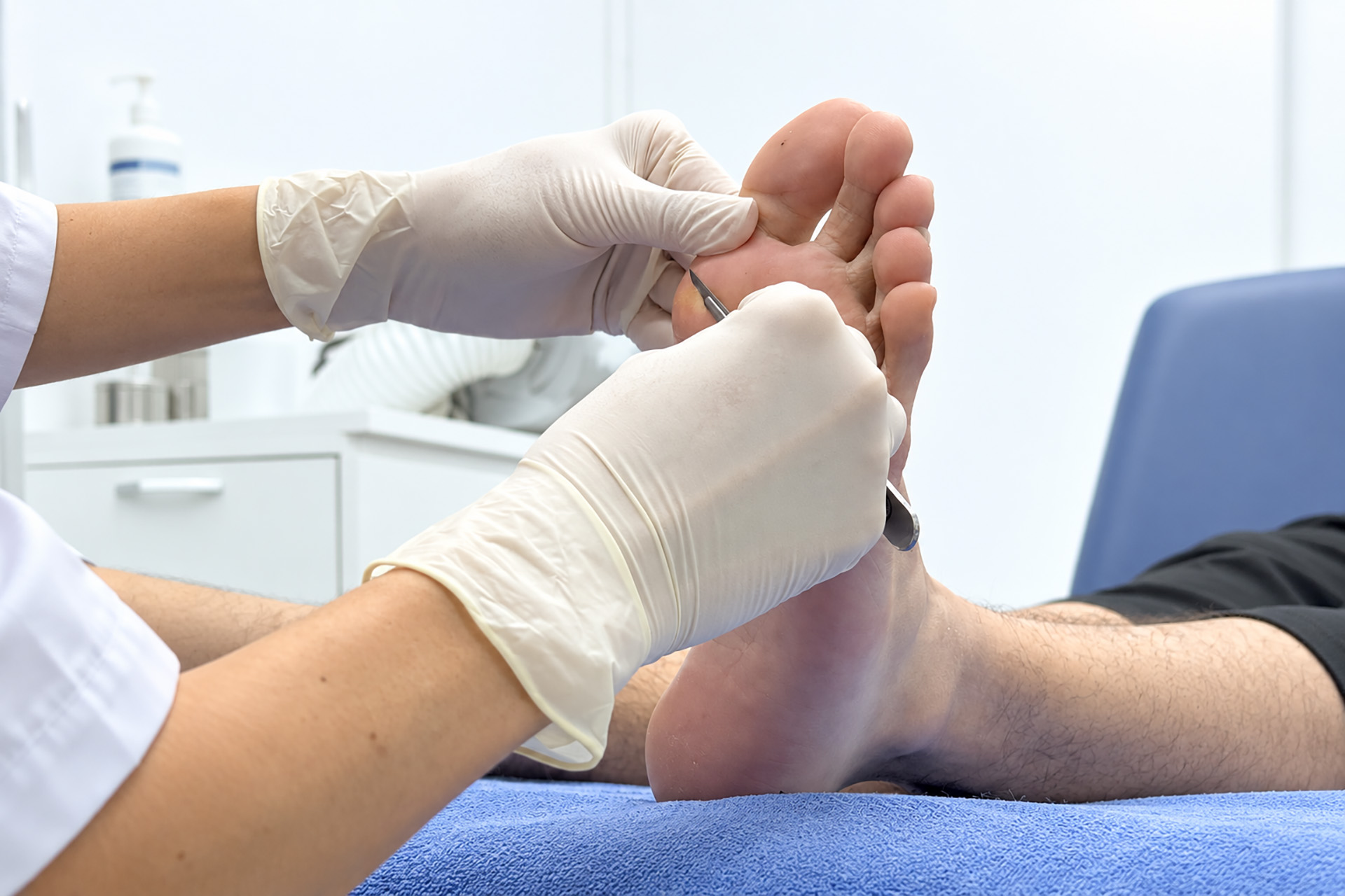 callus on toe