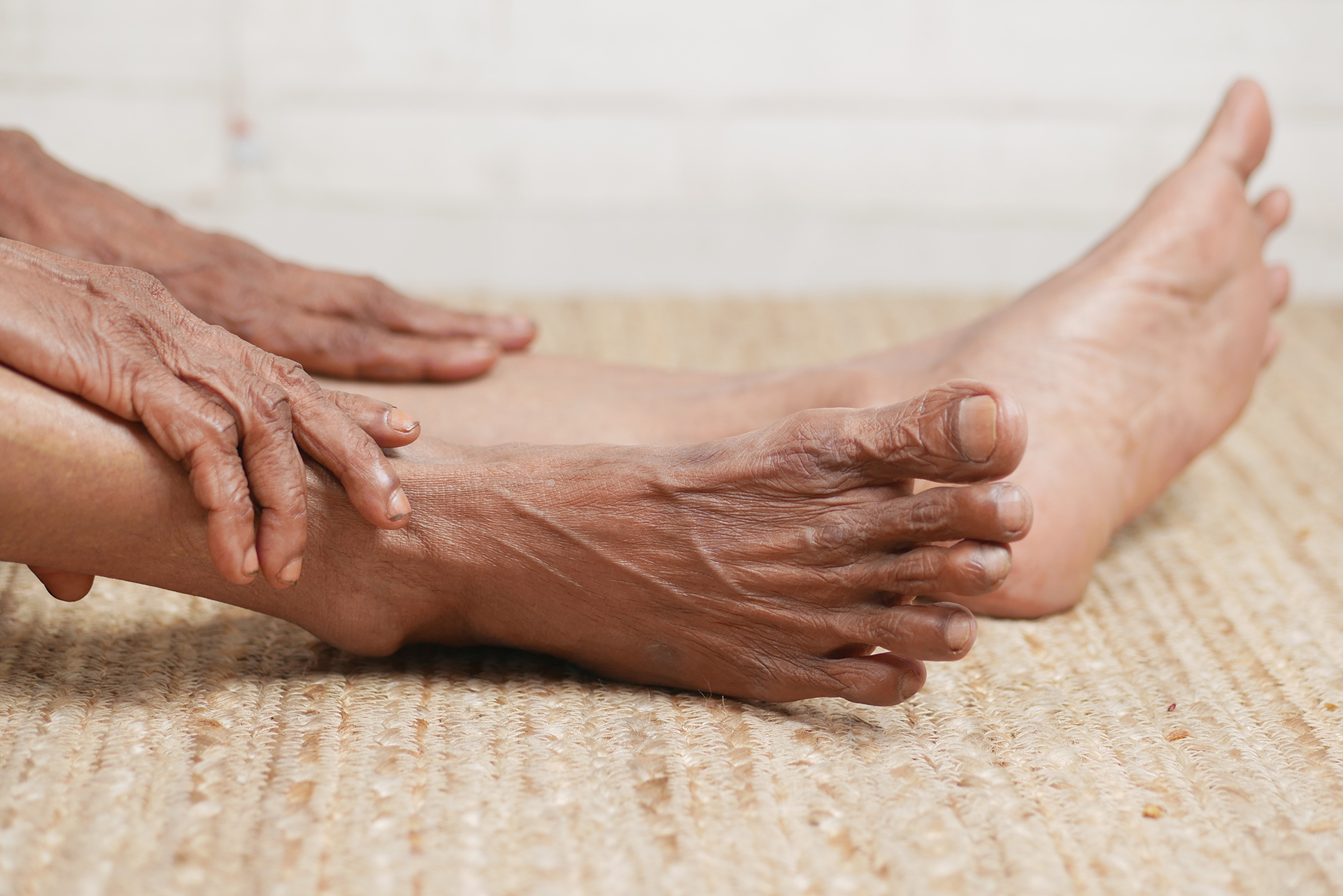 diabetic feet