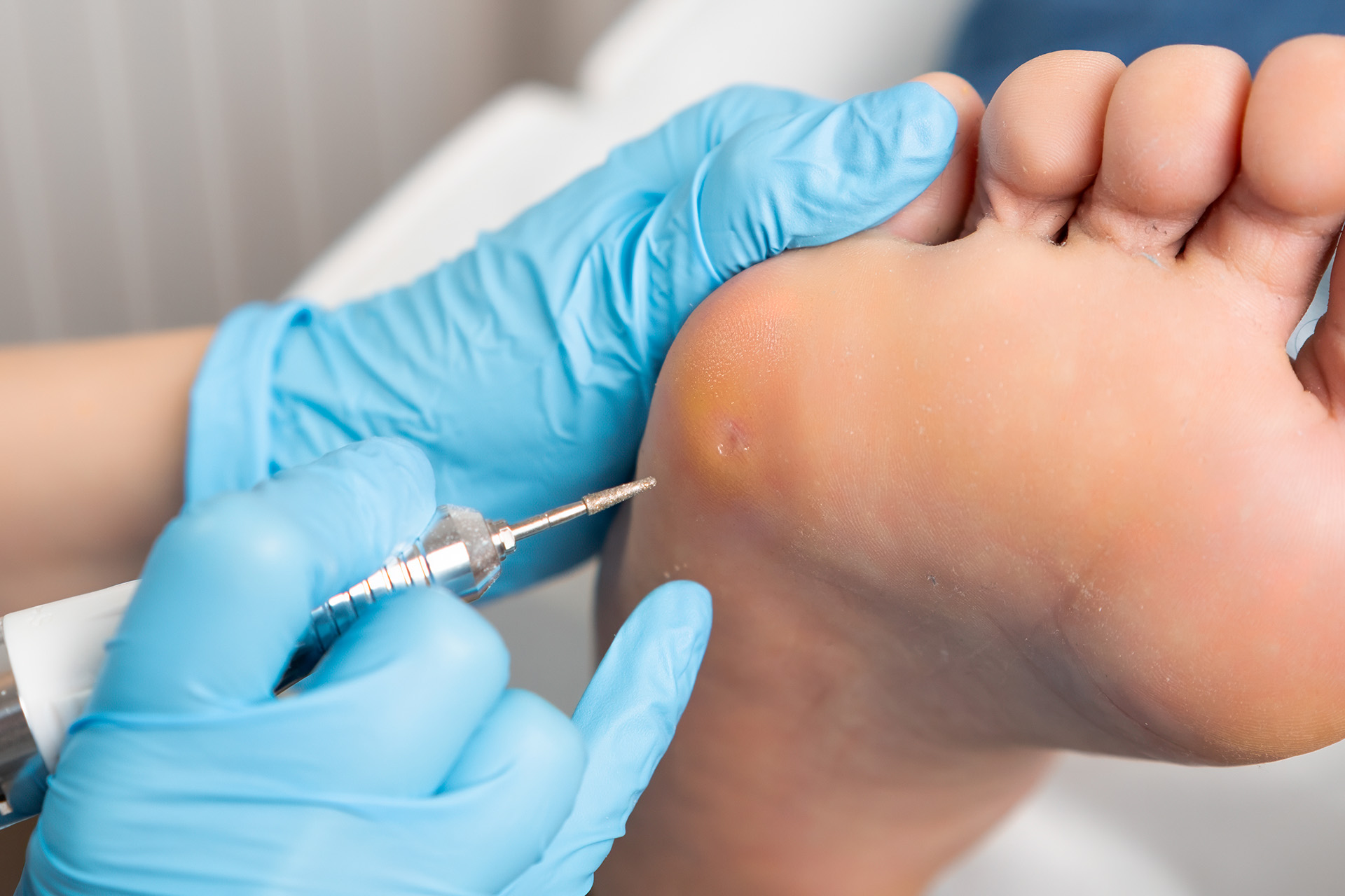 diabetic foot ulcer care