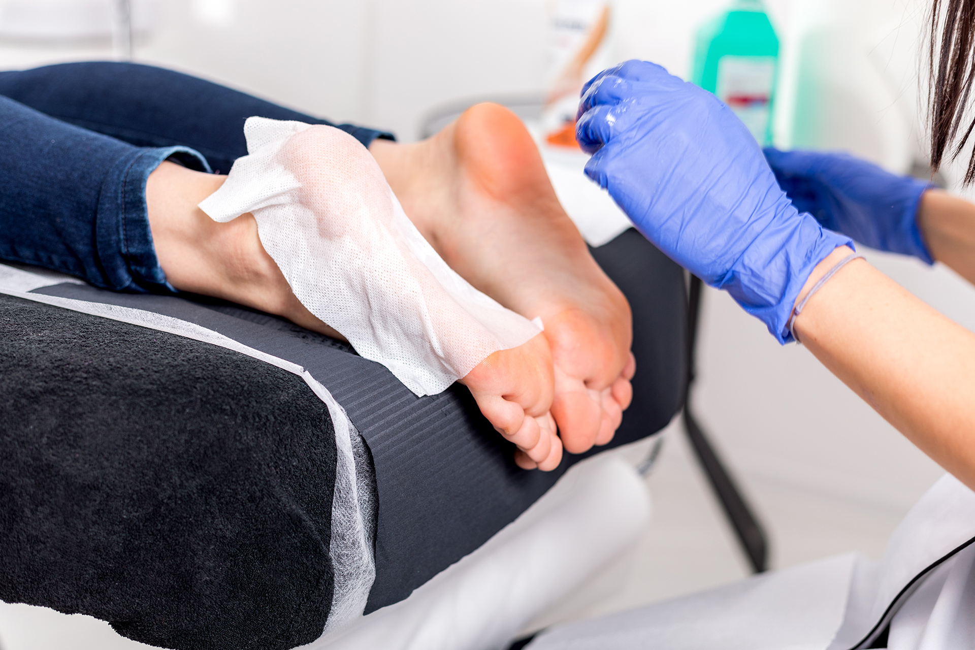 diabetic foot ulcer in Singapore
