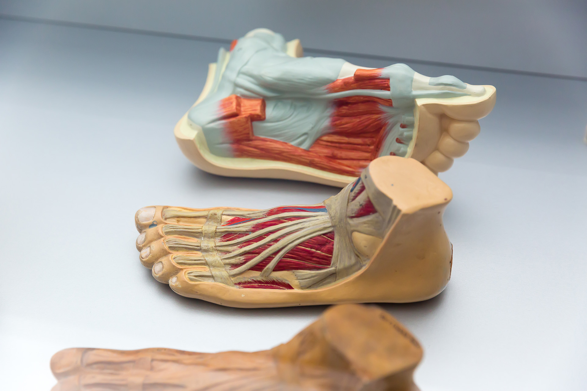flat foot arch pain