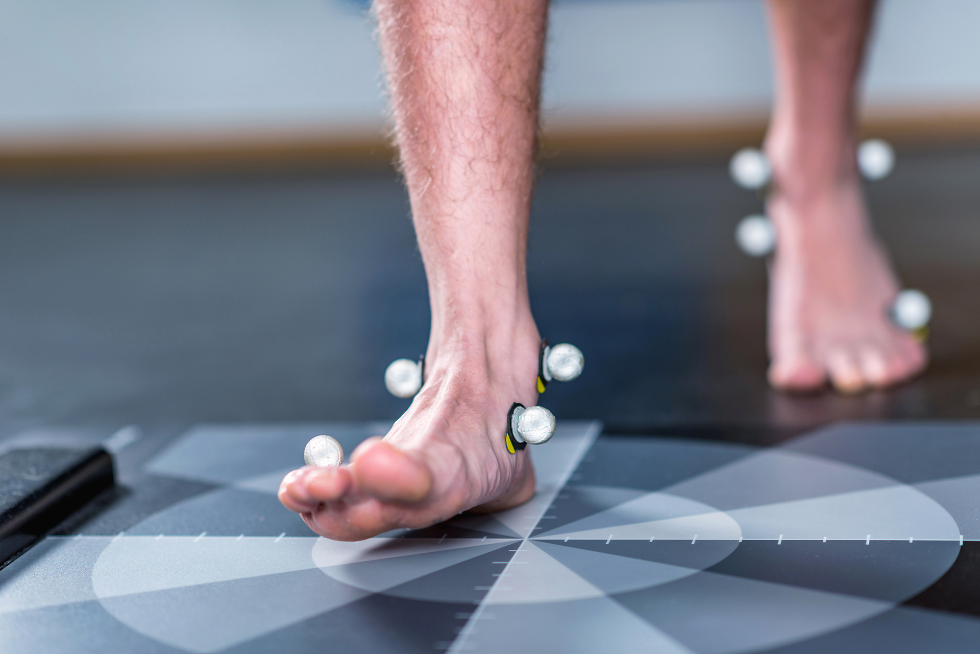 foot pain flat feet