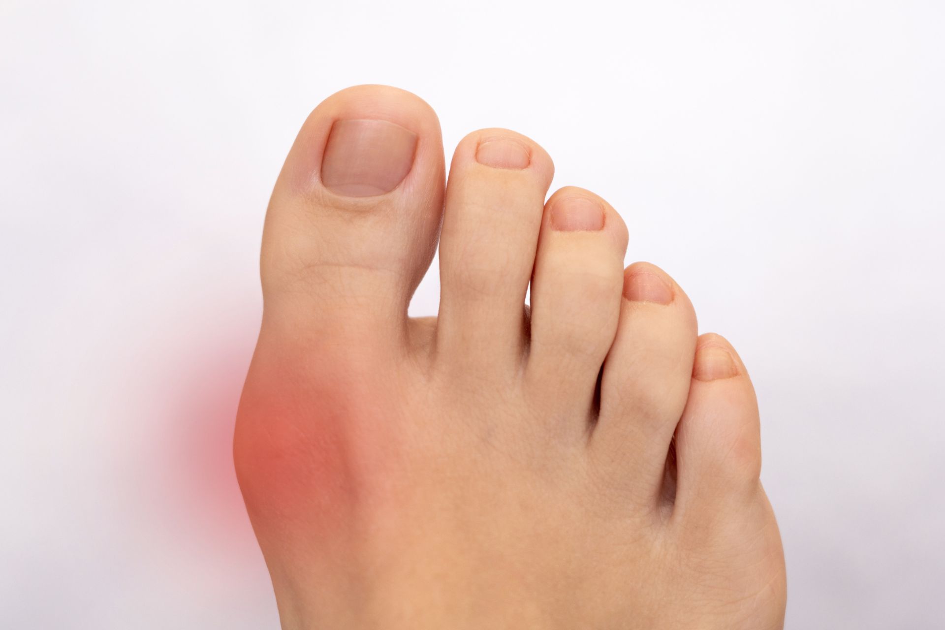 gout as a cause for top of foot pain