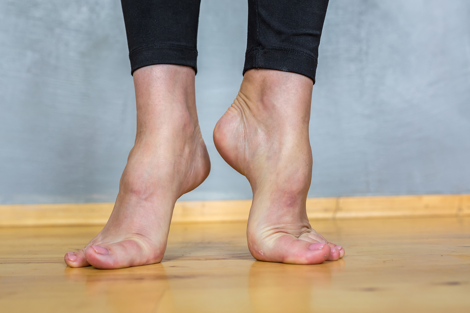 high arch feet