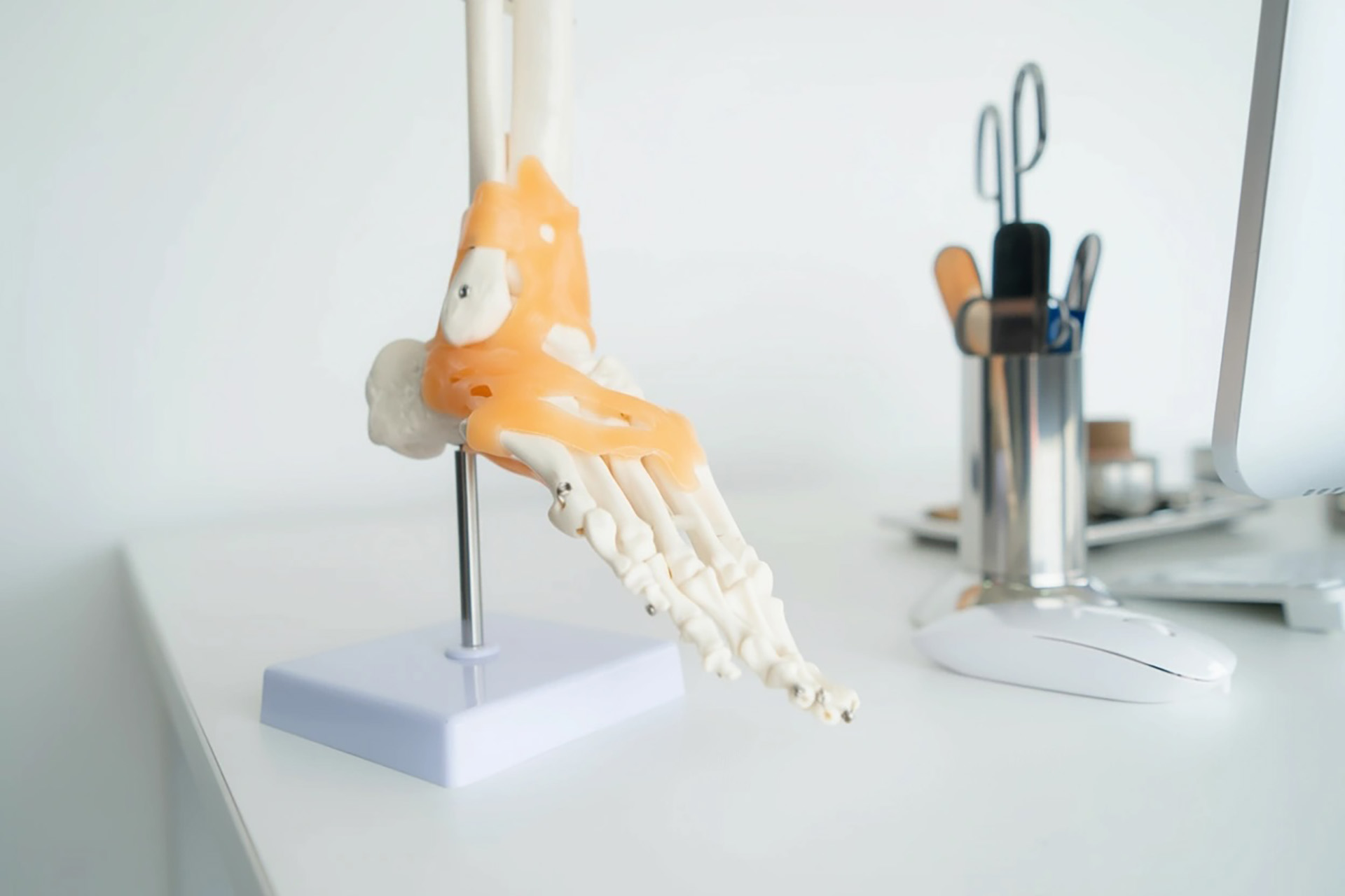 insertional achilles tendonitis pain