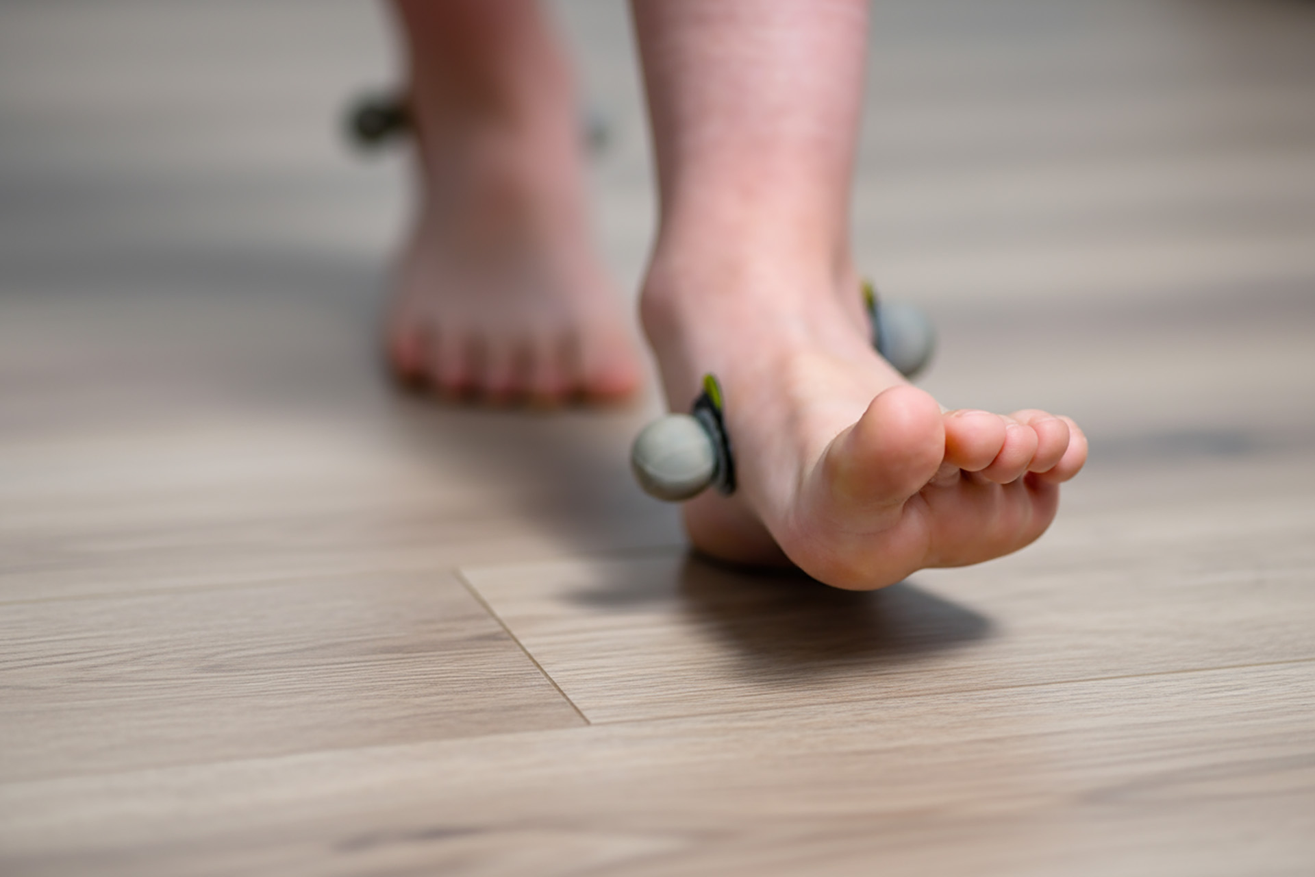 orthotics bunions in Singapore