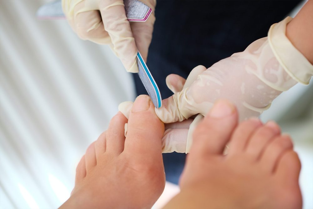 Treat Your Feet to Medical Pedicures in Singapore by Leading Podiatrist