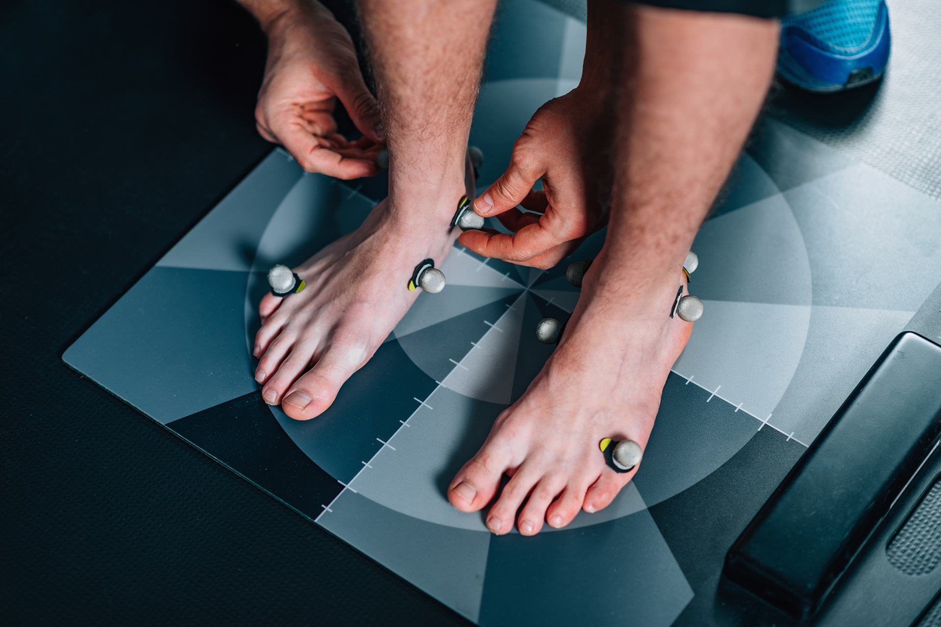 posterior shin splints gait analysis