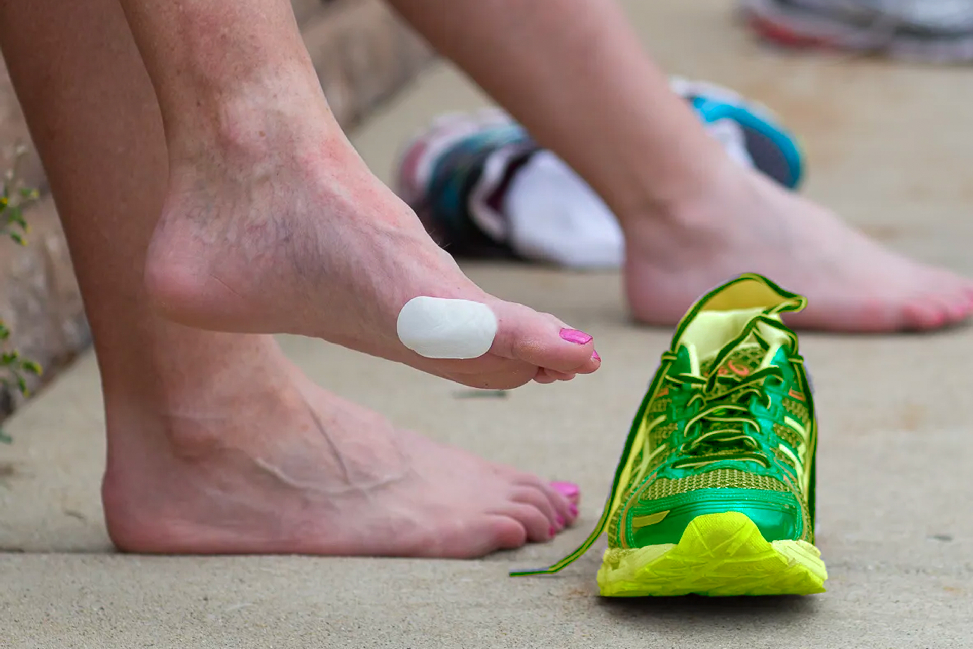 running blister treatment for feet